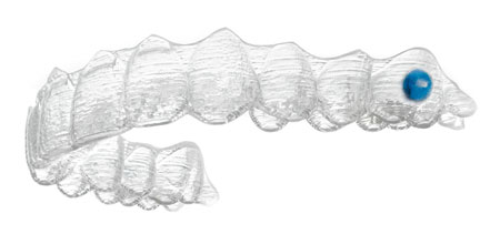 Invisalign® Invisalign®