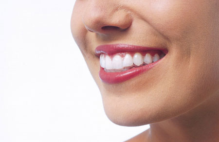 Invisalign® Invisalign®