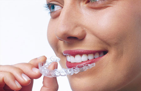 Invisalign® Invisalign®